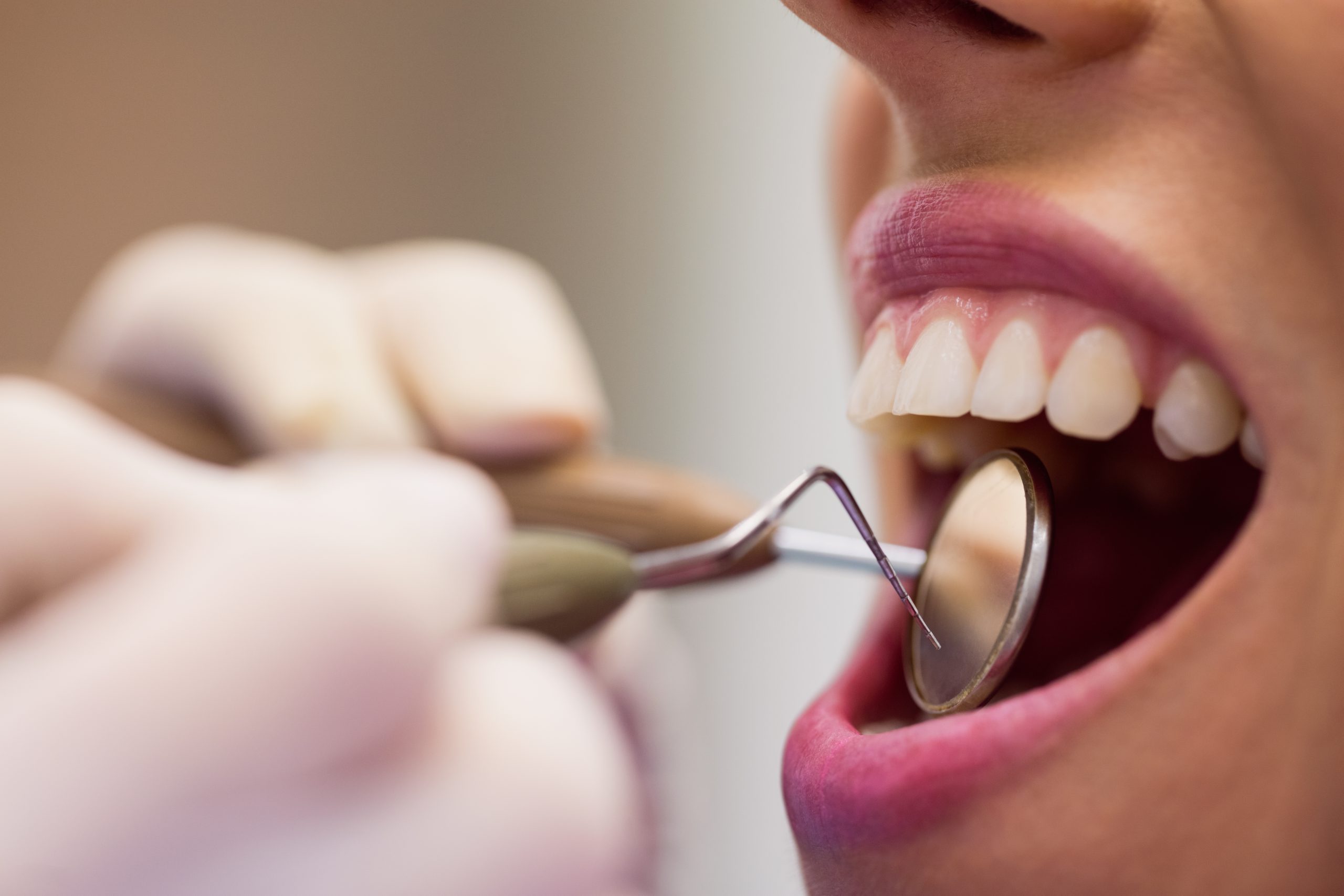 Pacjent podczas konsultacji w sprawie leczenia bezzębia z zastosowaniem implantów zygoma.


