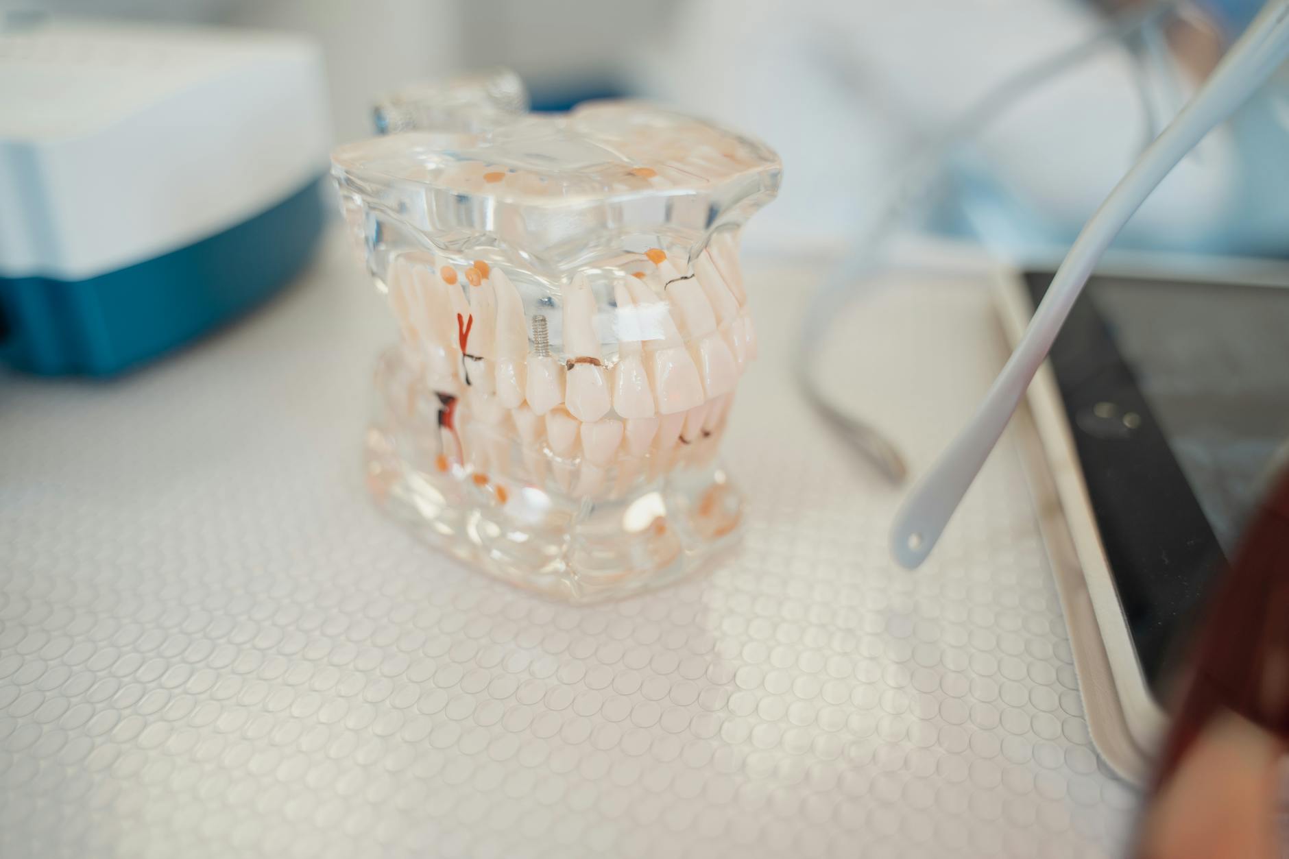 Kandydaci do implantów zębowych