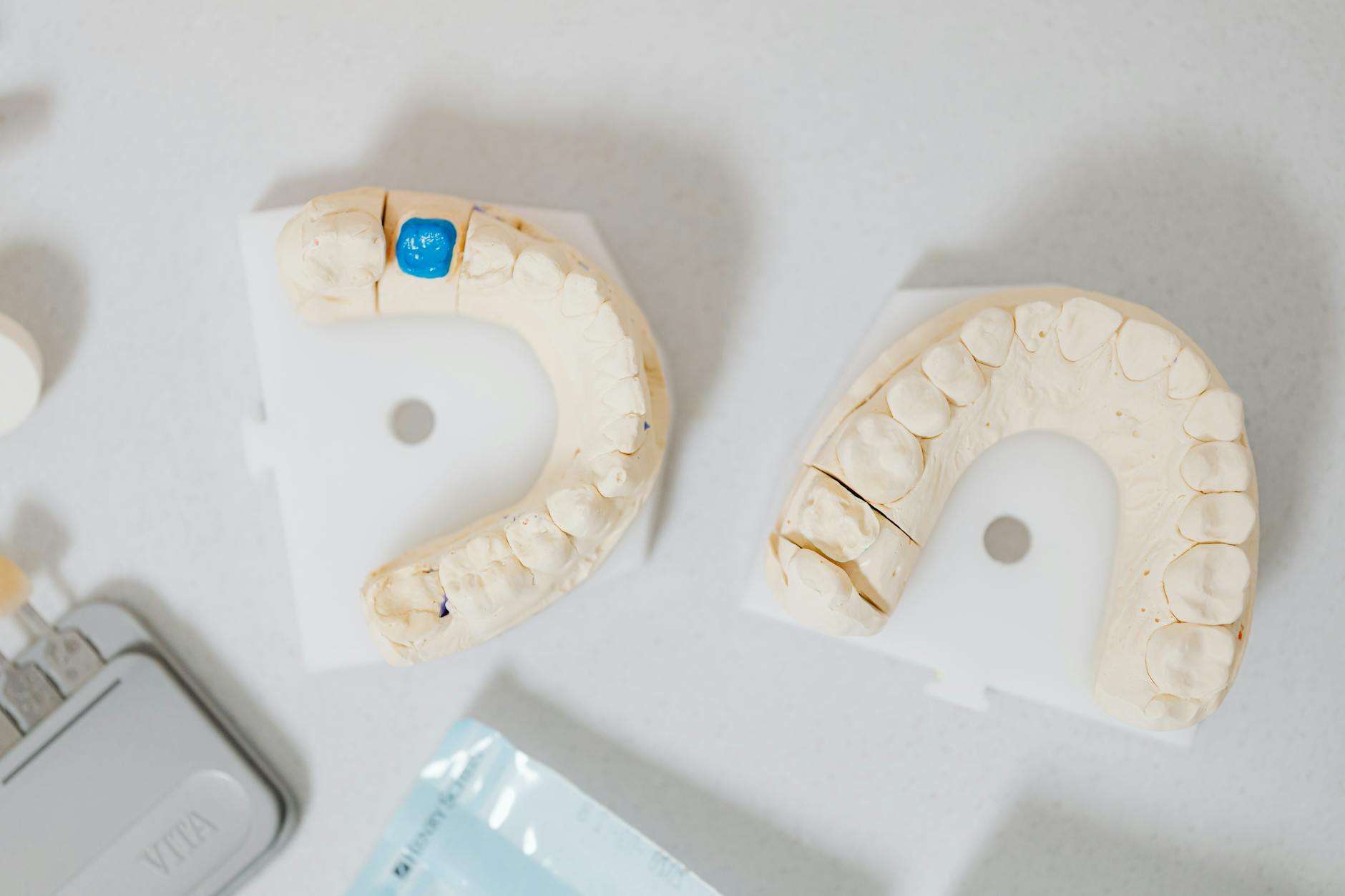 Planowanie i proces implantacji