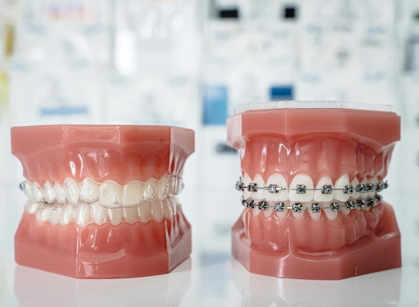 Dentysta Bieńczyce – zadbaj o zdrowy i piękny uśmiech