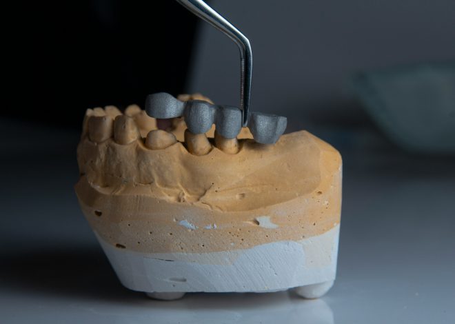 Porcelanowa, cyrkonowa czy metalowa? Jaką koronę na ząb wybrać w Krakowie