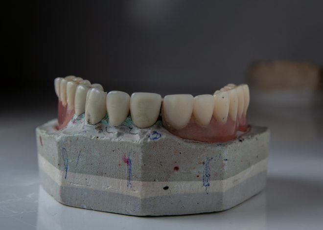 Mosty dentystyczne w Krakowie – trwały i estetyczny sposób na uśmiech bez braków