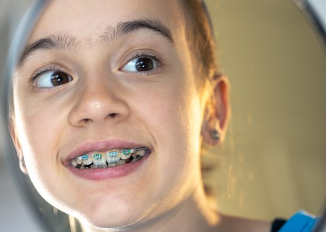 Aparat Brightalign – nowoczesne i dyskretne prostowanie zębów