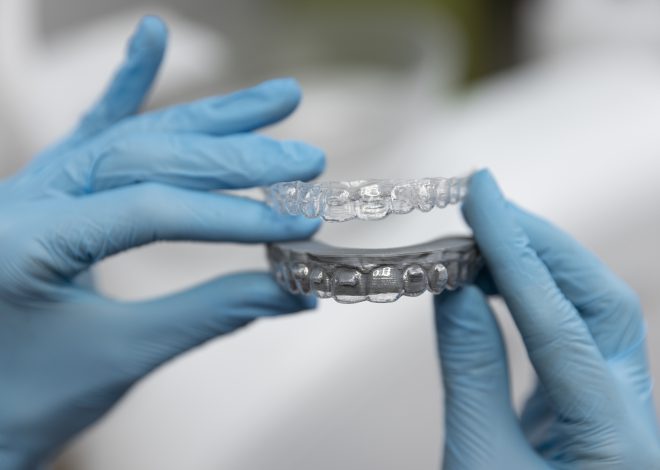 Aparat nakładkowy – nowoczesny sposób na prosty uśmiech