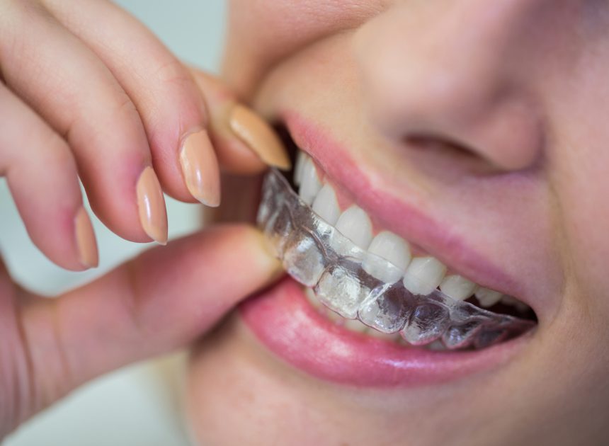 Dentysta dziecięcy w Krakowie – jak wybrać najlepszego stomatologa dla dziecka?